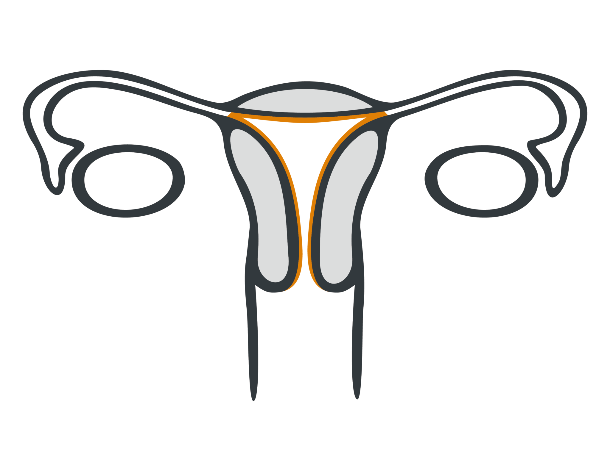 Gynäkologische Operationen - Was Sie wissen sollten